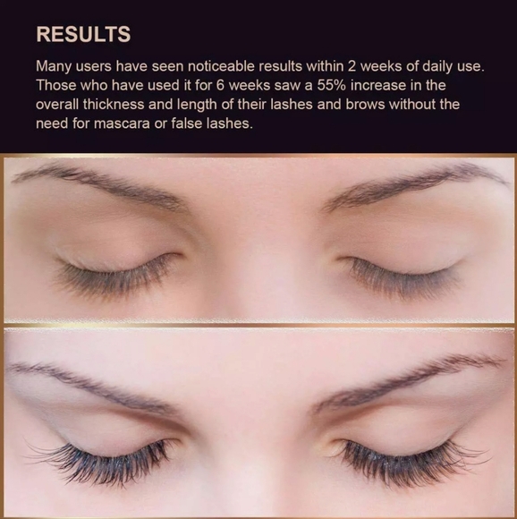 Silksence Eyelash Growth Serum for Lash and Brow Irritation Free Formula (5ML) - Picture 5 of 10